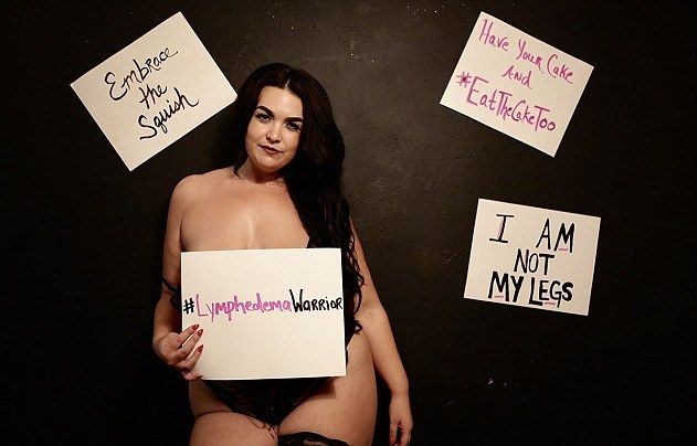 30-летняя женщина с большими отечными ногами стала сенсацией Instagram, начав позировать в сексуальном нижнем белье