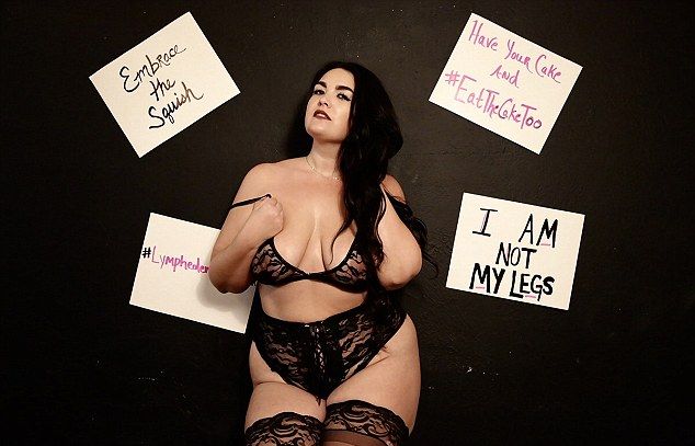 30-летняя женщина с большими отечными ногами стала сенсацией Instagram, начав позировать в сексуальном нижнем белье