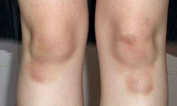 Примеры лайфхакинга Примеры лайфхакинга