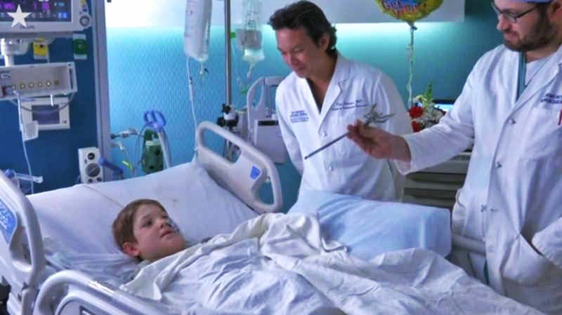 Мальчик проткнул голову шампуром и выжил Мальчик проткнул голову шампуром и выжил