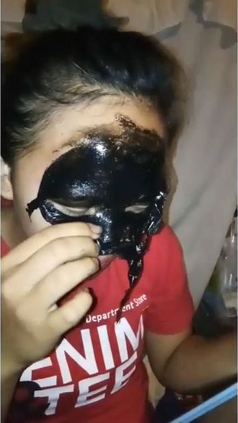 Черная маска для лица избавила девушку не от угрей, а от бровей