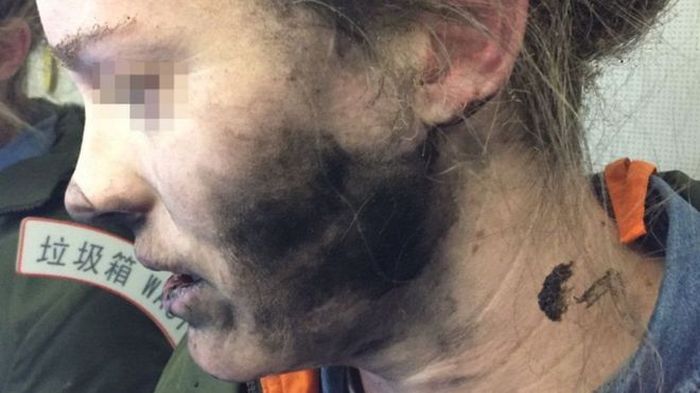 У пассажирки самолета взорвались наушники