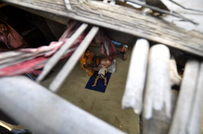 Девочка с гигантской головой (8 фото)