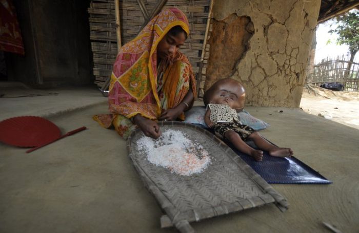 Девочка с гигантской головой (8 фото)