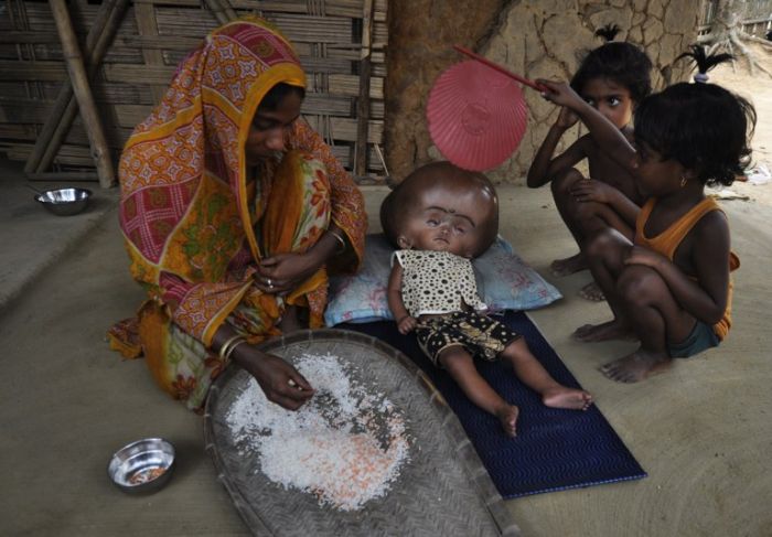Девочка с гигантской головой (8 фото)