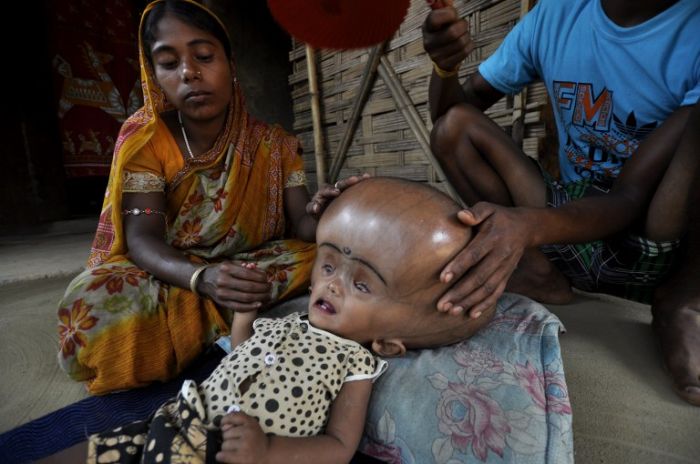 Девочка с гигантской головой (8 фото)