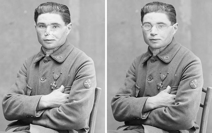 Скульптор, которая делала новые лица изуродованным во время Первой мировой войны солдатам