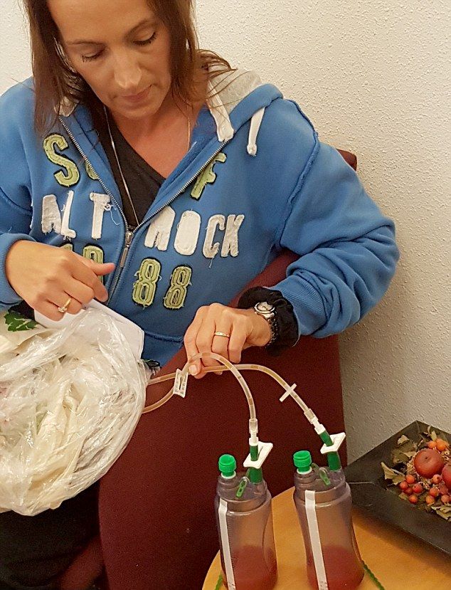 Грудь женщины начала гнить после вставки имплантатов