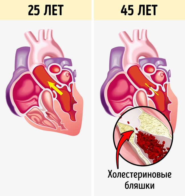10 вещей, которые происходят с вашим телом, когда вы сидите по 8 часов в день