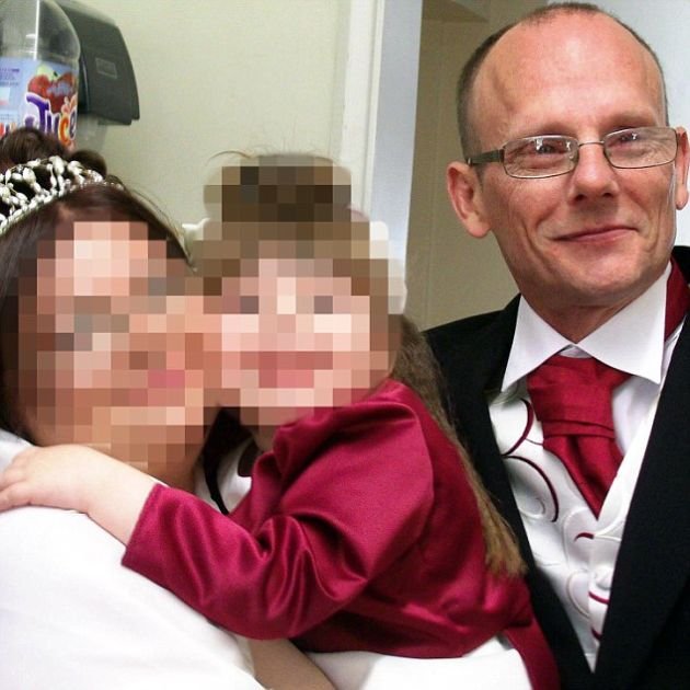 Британские власти признали трудоспособным мужчину, лишившегося части черепа