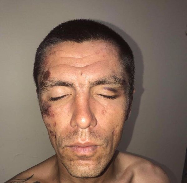 Жителя Белгорода увезли на допрос в полицию, где устроили ему пытки Жителя Белгорода увезли на допрос в полицию, где устроили ему пытки