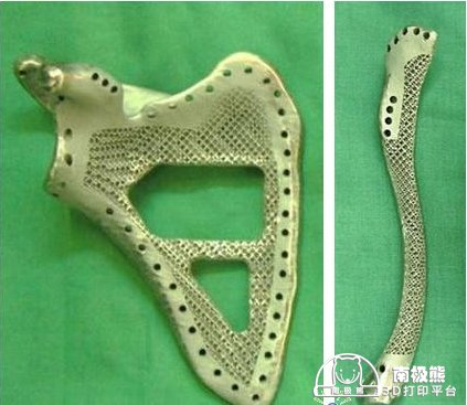 Титановые лопатки с помощью 3D-принтера