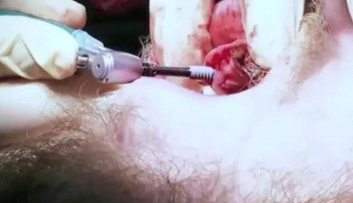 Вот как будут выглядеть зубы, если не чистить их 20 лет