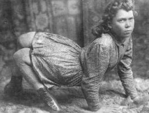 Женщины с редкими физическими недостатками, выступавшие в бродячих цирках
