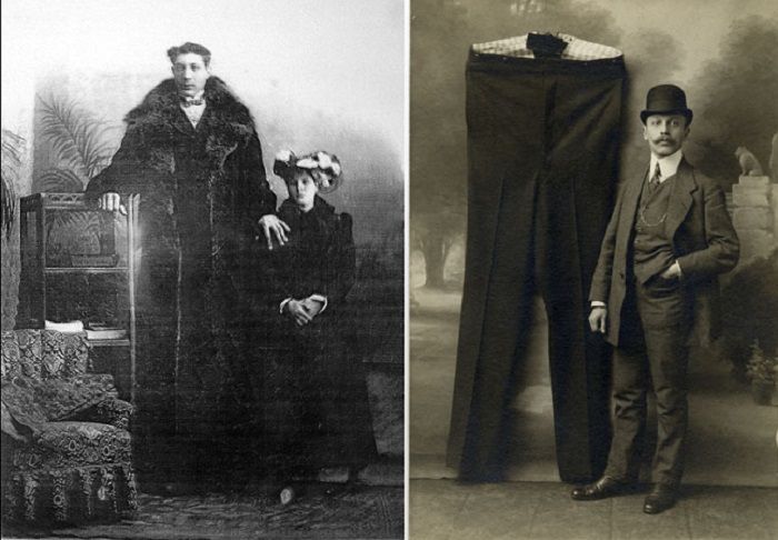 История самого высокого человека на планете
