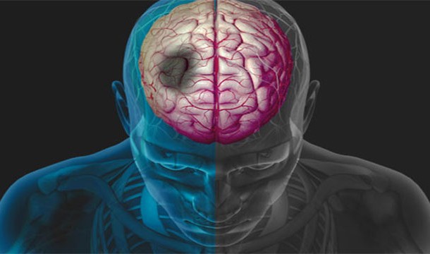 Каковы шансы умереть от того или иного бедствия?