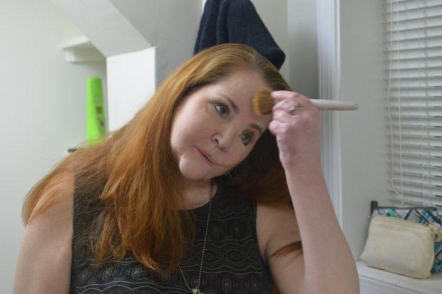 Женщина пережила попытку самоубийства, и рассказала о своей жизни после этого