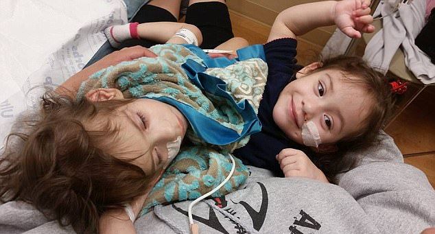 Хирургам удалось разделить сиамских близняшек с общим пищеварительным трактом и парой ног