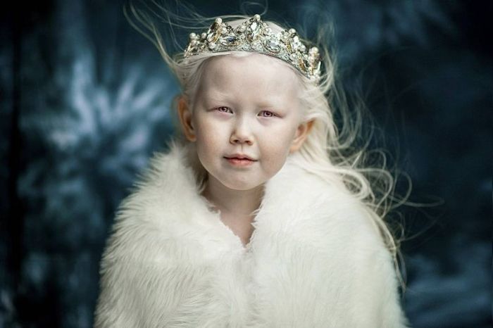 8-летняя девочка-альбинос Нарияна, которую зовут «Снежной королевой»