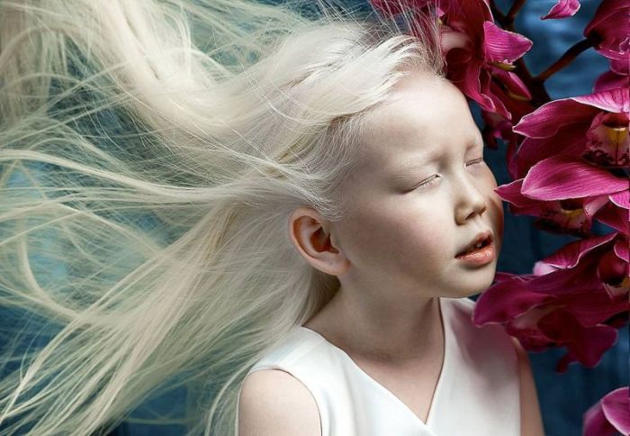 8-летняя девочка-альбинос Нарияна, которую зовут «Снежной королевой»