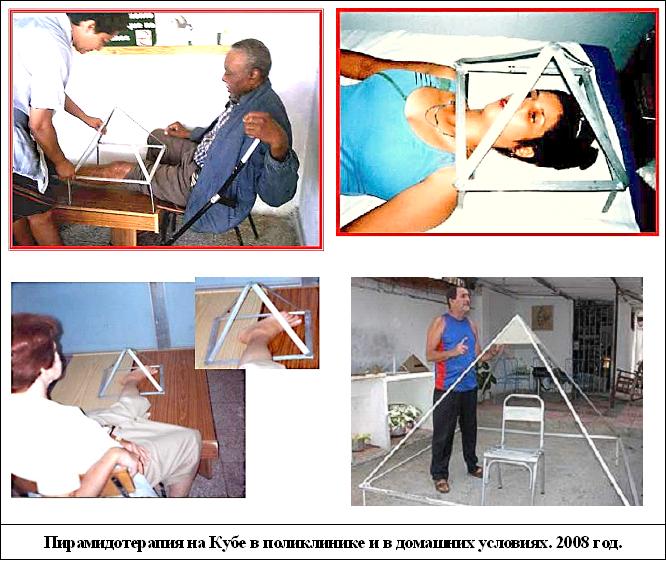 Пирамидотерапия