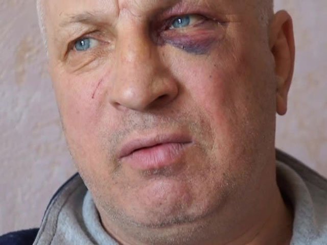 За интервью с "Беркутом" киевского блогера пытали прямо на Майдане За интервью с "Беркутом" киевского блогера пытали прямо на Майдане