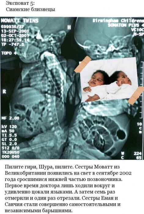 Странные предметы внутри пациентов