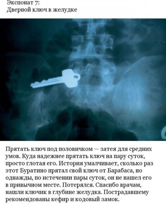 Странные предметы внутри пациентов