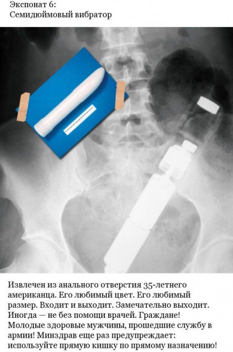 Странные предметы внутри пациентов