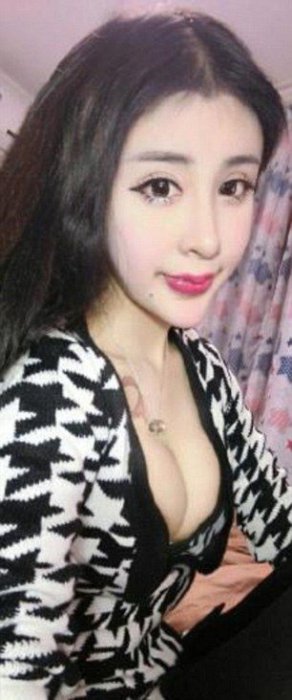  Пластика в 15 лет