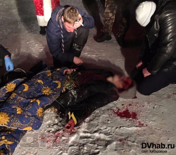 Новогодняя петарда убила жителя края, взорвавшись у него в глазном отверстии