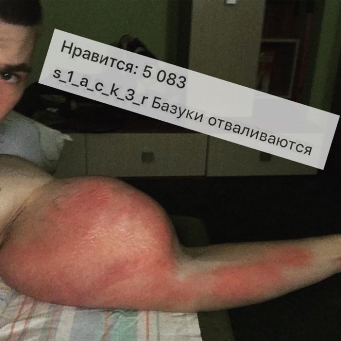 Синтольный Кирилл жалуется на руки-базуки