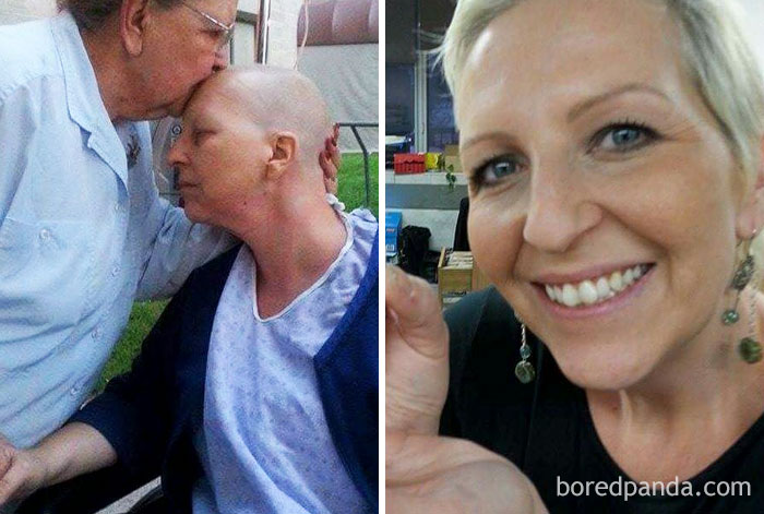 Люди, которые победили рак, в фотографиях «до и после»