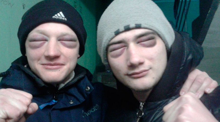 Польза хозяйственного мыла в быту Польза хозяйственного мыла в быту