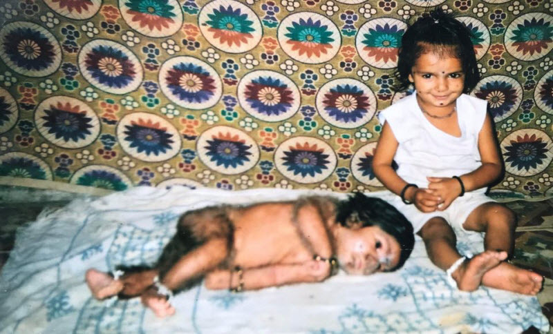 Индийский оборотень: лицо 13-летнего мальчика покрыто волосами