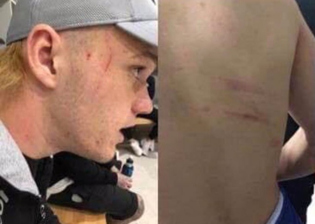 Турецкий футболист Мансур Чалар пронес лезвие на матч и незаметно наносил удары соперникам