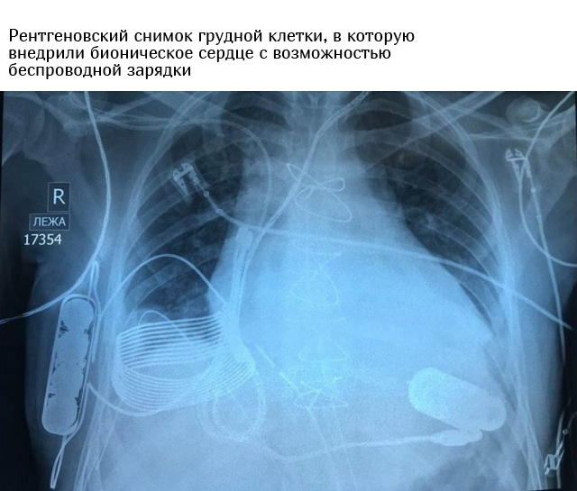 Интересные фото и факты обо всем на свете