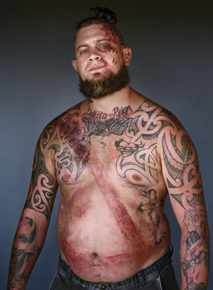 Портреты мужчин, которые выжили в аварии благодаря ремню безопасности