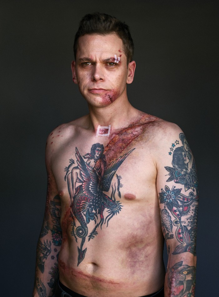 Портреты мужчин, которые выжили в аварии благодаря ремню безопасности