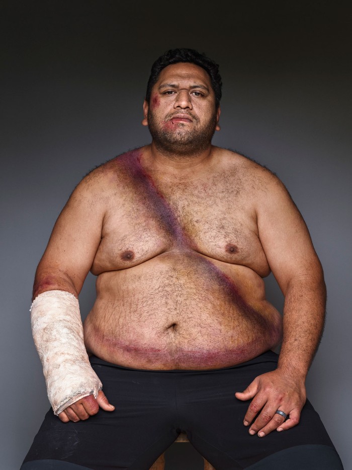 Портреты мужчин, которые выжили в аварии благодаря ремню безопасности