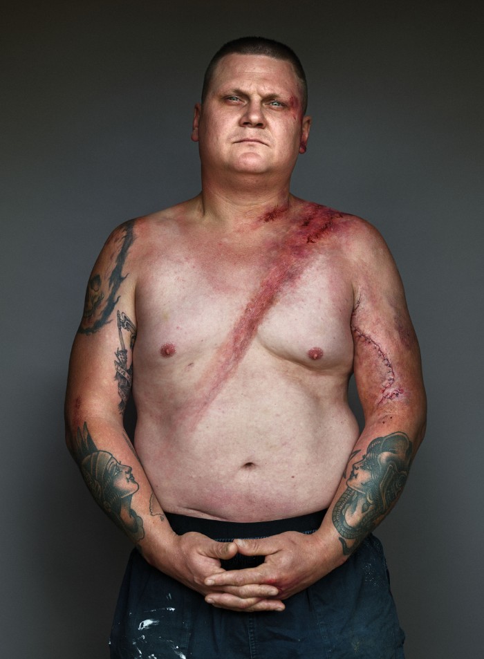 Портреты мужчин, которые выжили в аварии благодаря ремню безопасности