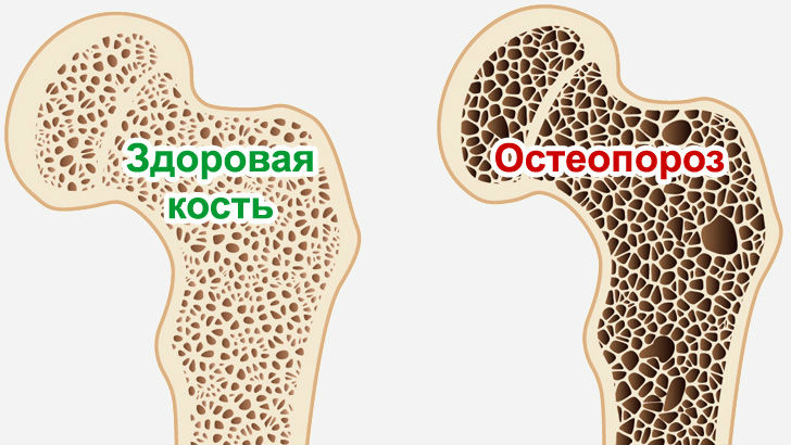 Жительнице Китая «постарела» на 30 лет из-за любви к кофе