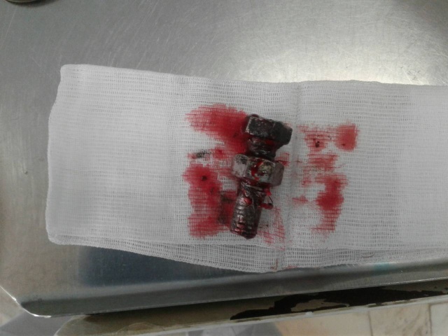 Из-под колеса грузовика вылетел болт, который попал в голову лесосибирцу