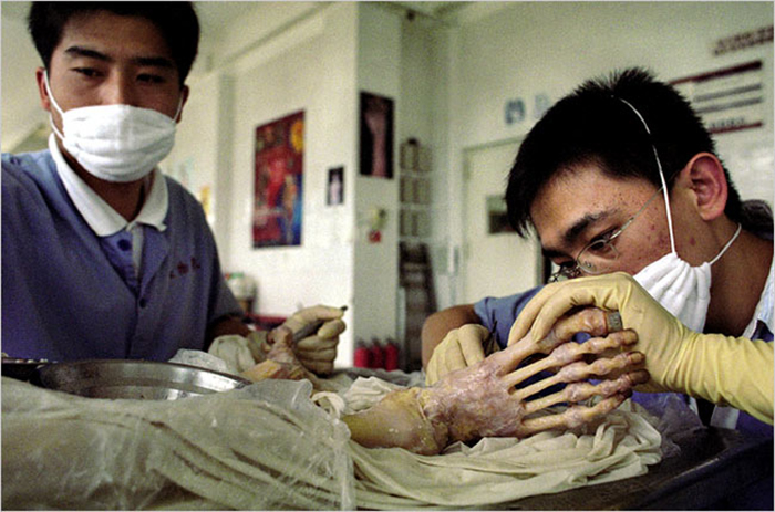 Экспонаты анатомической выставки Body Worlds могут скрывать жуткую тайну