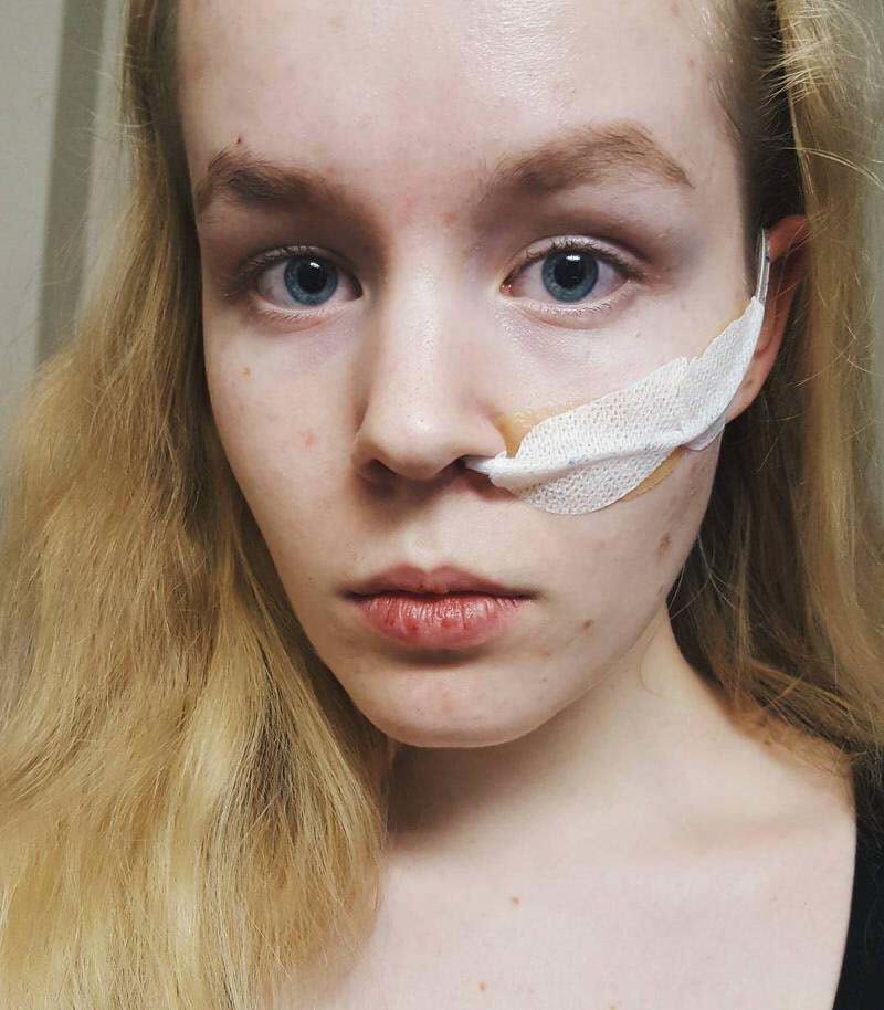 17-летняя жертва изнасилования подверглась эвтаназии