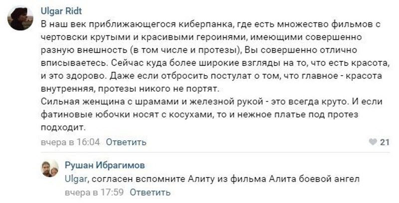 Девушка, которой ревнивый муж отрубил руку, снялась в откровенной фотосессии