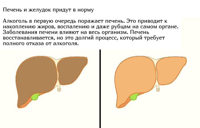 Что будет с организмом, если перестать принимать алкоголь