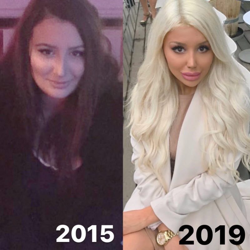 19-летняя шведка потратила состояние, чтобы стать похожей на куклу Барби