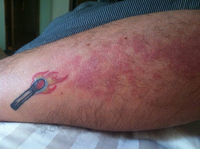 Люди с родимыми пятнами, которые не растерялись и сделали их частью татуировок