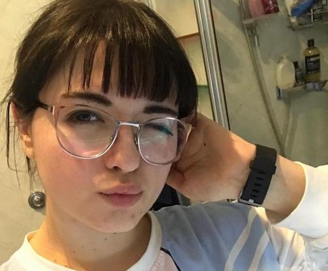 Око Саурона: итальянка никогда не смотрит людям в глаза из-за редкой патологии зрачка